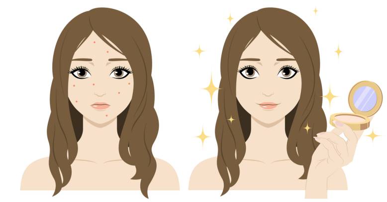 Before and after applying acne concealer