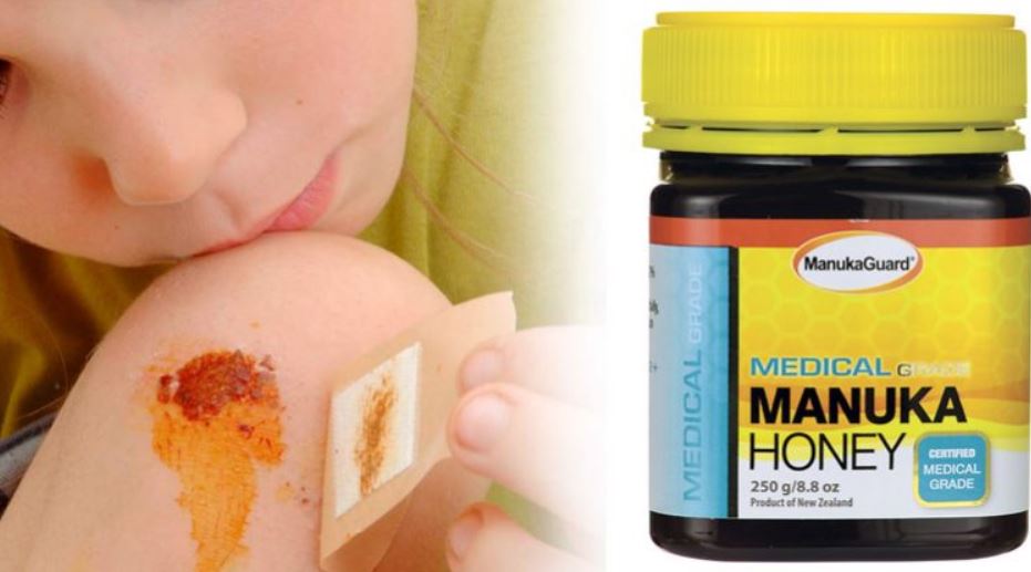 Medical Manuka honey for wounds
