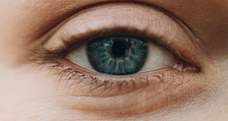 Under Eye Wrinkles
