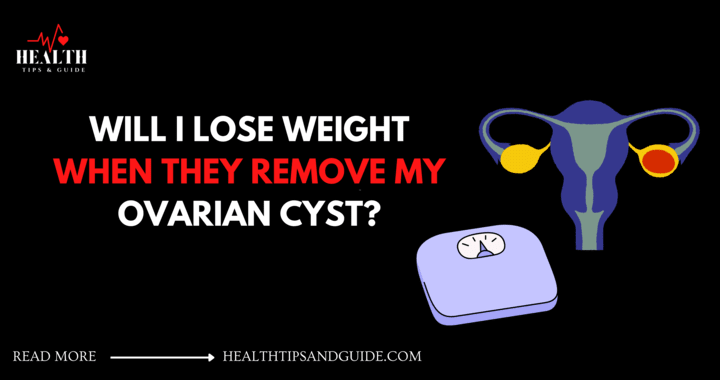 Will I Lose Weight When They Remove Ovarian Cyst